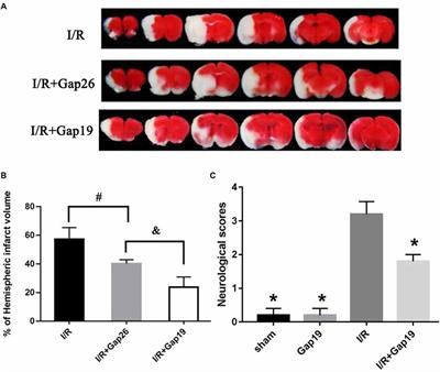 Inhibition of Connexin 43 Hemichannels Alleviates Cerebral Ischemia/Reperfusion Injury via the TLR4 Signaling Pathway